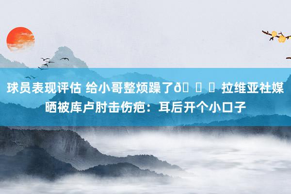 球员表现评估 给小哥整烦躁了😅拉维亚社媒晒被库卢肘击伤疤：耳后开个小口子